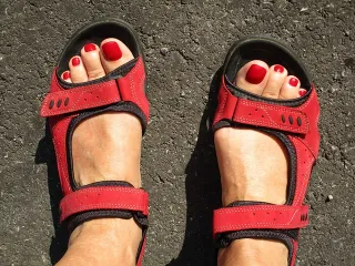 feet with bunions in sandals